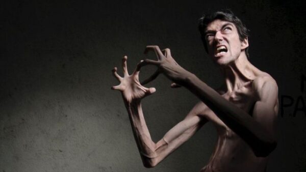 marfan-syndrome-horror-movie-actor-javier-botet-11-5cee3ee68aa2c__700