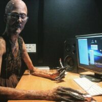 marfan-syndrome-horror-movie-actor-javier-botet-9-5cee3ee31a88d__700 