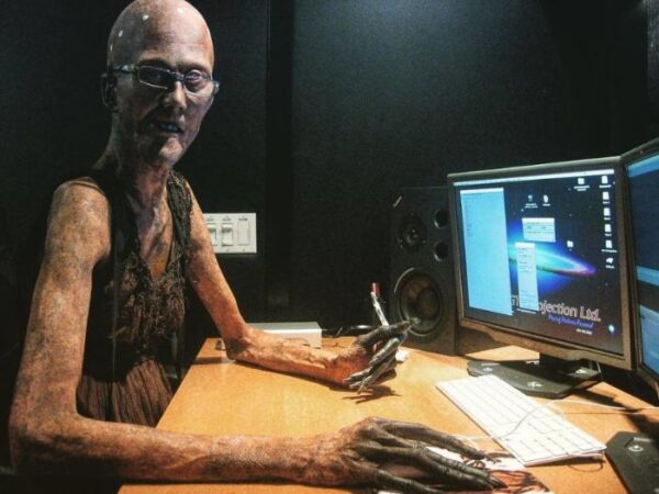 marfan-syndrome-horror-movie-actor-javier-botet-9-5cee3ee31a88d__700
